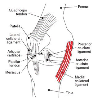 Medial Collateral Ligament Injuries of the Knee (MCL Tear