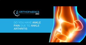 Is your ankle pain from ankle arthritis Mike smith orthopaedic surgeon