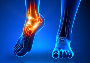 Ankle pain mike smith Ankle surgeon adelaide