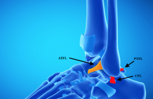 ankle lateral ligaments ankle arthroscopy ankle sprain best anatomy