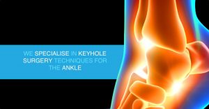 ankle surgery adelaide mike smith